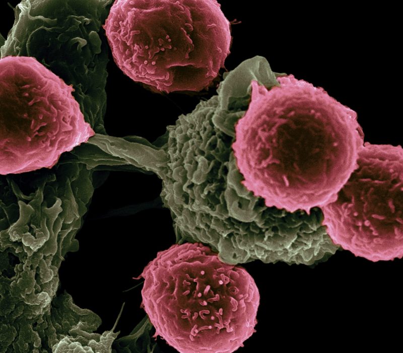 national-cancer-institute-LnvCEXQwC-o-unsplash (1)